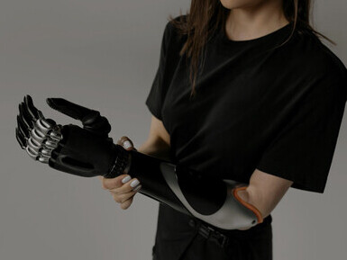 The bionic arm worn by the woman highlights how assistive technology can enhance mobility and independence