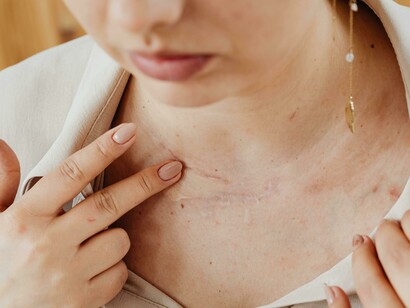 A woman applies concealer to cover a scar, symbolizing fear, domestic violence, and abuse