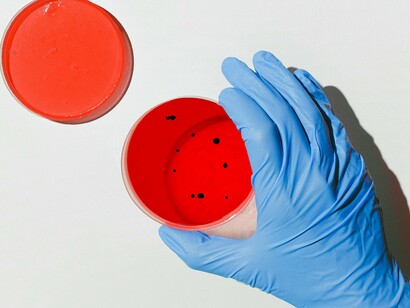 A Wolbito do Brasil atende à crescente demanda nacional pelo Método Wolbachia, que se tornou uma política de saúde pública do Ministério da Saúde. Ocupa uma área de mais de 3.500 m², possui equipamentos de última geração para automação e criação de mosquitos Wolbachia, além de uma equipe de cerca de 70 funcionários. Inicialmente, a unidade atenderá exclusivamente ao Ministério da Saúde. Isso garantirá que os mosquitos Wolbito sejam distribuídos para as diversas regiões do Brasil que apresentam alta incidência de dengue