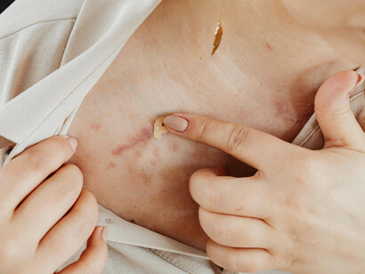 A woman covering a scar with concealer, representing the fear and silence surrounding domestic violence and abuse