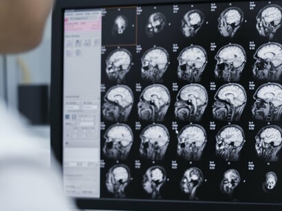 Imaging the brain reveals structure, but not the full story of the mind