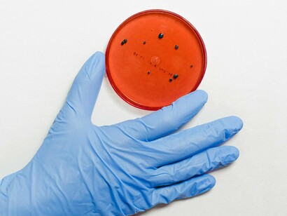 A Wolbachia está presente em 60% dos insetos e, quando injetada no Aedes aegypti durante estudos, impediu o desenvolvimento da dengue, zika, chikungunya e outros vírus arbovírus. Isso reduziu a transmissão dessas doenças. Quando mosquitos com Wolbachia são liberados no meio ambiente, eles se reproduzem com mosquitos selvagens. Isso produz uma nova geração com menor capacidade de transmitir esses arbovírus. Com o tempo, a proporção de mosquitos infectados com a bactéria aumenta e substitui a cepa selvagem, eliminando a necessidade de novas liberações