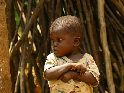 A child in tattered cloth looking sickly, representing how many children still go hungry and lack access to basic necessities