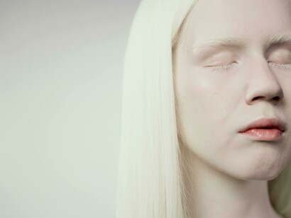 Donna con albinismo. "Dare un nome agli invisibili è già un primo passo": i dettagli e le sfumature sono essenziali per la lotta contro gli stereotipi nella costruzione dei personaggi