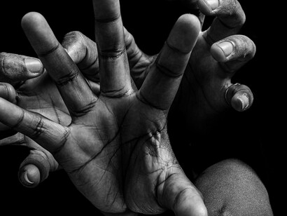 Mas fiquei intrigado com o fato de existir a predominância entre dois órgãos idênticos, num mesmo corpo. Por que isso? Será que, até neste caso, a igualdade é uma utopia?