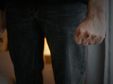 A violent-prone man with wounded, bruised hands
