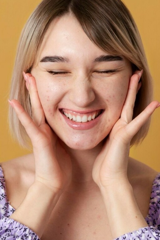 A woman with acne poses against a yellow background, highlighting skincare