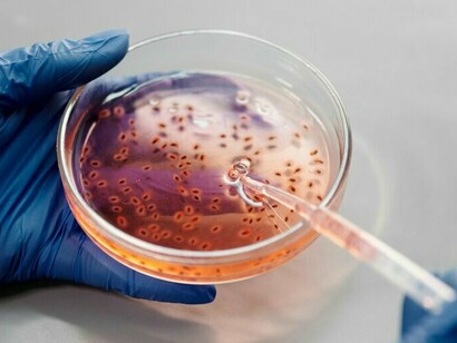 Un technicien de laboratoire prélève un échantillon dans la boîte de Pétri