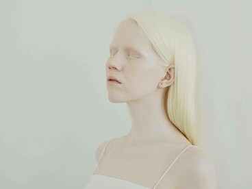 Donna con albinismo. Riconoscere l'esistenza: l'autrice si impegna a raccontare storie di chi si sente invisibile, dando spazio e dignità a ogni protagonista e contribuendo a una rappresentazione autentica