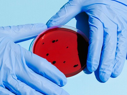 Cultura de bactérias. A. muciniphilia é enriquecida na camada de muco do revestimento intestinal<sup>7</sup>. Tal como outras bactérias intestinais saudáveis, produz ácidos gordos de cadeia curta através da fermentação de fibras alimentares. Também decompõe as glicoproteínas chamadas mucinas e desempenha um papel significativo na manutenção da barreira intestinal e na regulação imunitária. Ou seja, as mucinas são uma classe de proteínas que são revestidas com muitos açúcares. Criam uma barreira física que protege as células epiteliais de danos, agentes patogénicos e irritantes

