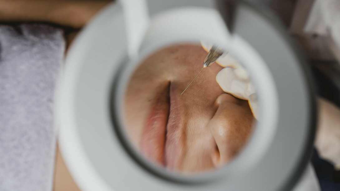 With minimal cost and less recovery than surgery, dermal fillers are a cornerstone of modern, accessible aesthetics