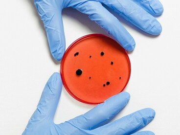 A tecnologia produz mosquitos infectados com Wolbachia, uma bactéria que bloqueia o desenvolvimento de vírus dentro do Aedes aegypti, impedindo sua transmissão. Inicialmente, esses mosquitos foram produzidos em pequena escala na biofábrica da Fiocruz, no Rio de Janeiro. Com a expansão do método, o Ministério da Saúde busca tornar o controle de arbovírus mais eficiente, superando o modelo tradicional focado exclusivamente em inseticidas



