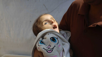 A 4-year-old Palestinian girl, lost her life due to malnutrition and lack of treatment due to the war on Gaza