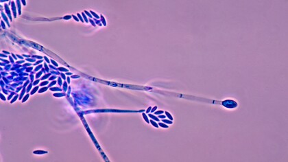 Il Fusarium venenatum è un fungo microscopico appartenente al genere Fusarium