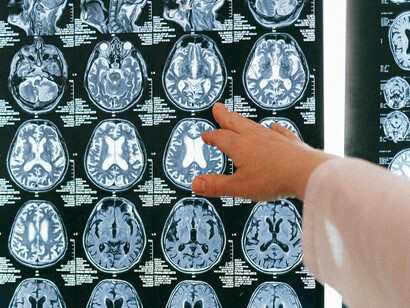 Essa semelhança levou muitos a especularem que o universo poderia funcionar como um cérebro gigantesco, ou que o cérebro humano seria uma miniatura do cosmos. Embora sejam ideias mais próximas da metáfora do que da ciência comprovada, os dados quantitativos reforçam que as similaridades não são apenas visuais