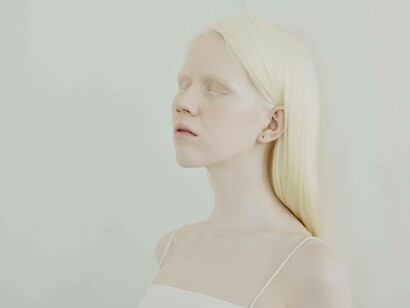 Donna con albinismo. Riconoscere l'esistenza: l'autrice si impegna a raccontare storie di chi si sente invisibile, dando spazio e dignità a ogni protagonista e contribuendo a una rappresentazione autentica