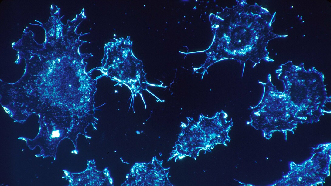 Células cancerosas en cultivo, provenientes del tejido conectivo humano