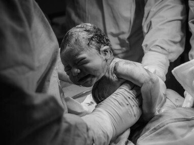 The moment of cesarean delivery, reminding us why women’s experiences and consent must never be overlooked