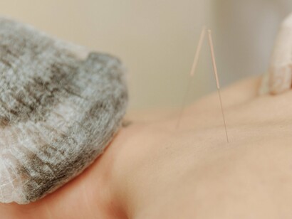 A blend of tradition and science, acupuncture continues to offer relief where conventional methods may not