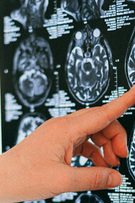 El sistema nervioso entérico y el microbioma intestinal ¡son tu segundo cerebro!