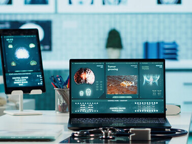 Improving workflow efficiency in radiology through AI-powered systems