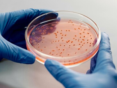Les boîtes de Petri offrent un environnement contrôlé pour la croissance bactérienne, permettant aux scientifiques d’étudier et d’identifier différentes espèces