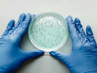 Los biomarcadores diagnósticos permiten identificar con precisión la presencia de una enfermedad en sus primeras etapas