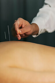 Experience the healing power of acupuncture with a skilled Chinese medicine practitioner providing traditional treatment