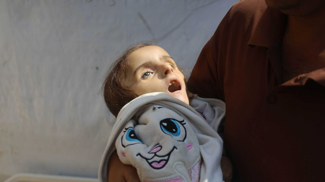 A 4-year-old Palestinian girl, lost her life due to malnutrition and lack of treatment due to the war on Gaza