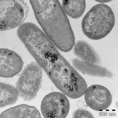 Microscopia elettronica a sezione ultrasottile del fago Escherichia vB_EcoP_SU10 (Kuravirus SU10). I capisidi vuoti dei fagi si attaccano ai recettori della superficie batterica e i loro genomi vengono iniettati nell'ospite. Le teste dei fagi progenitori sono disposte una accanto all'altra nel citoplasma batterico e formano una struttura a nido d'ape. Alcune delle teste sono piene di genomi, mentre altre sono in fase di confezionamento del genoma. Di Mohammadali Khan Mirzaei, Harald Eriksson, Kie Kasuga, Elisabeth Haggård-Ljungquist, Anders S. Nilsson