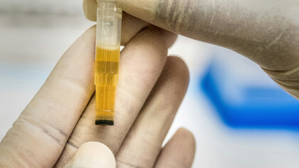 La recolección de orina en barrios del conurbano expone una trama poco visible donde lo cotidiano, lo legal y lo farmacéutico se cruzan en silencio