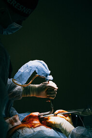 Médicos em momento crítico de cirurgia estudam cada passo para a retirada de um tumor do paciente