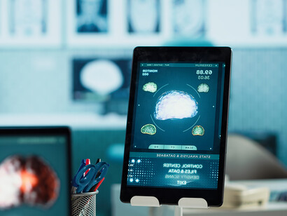 AI as a second reader in radiology, enhancing diagnostic accuracy