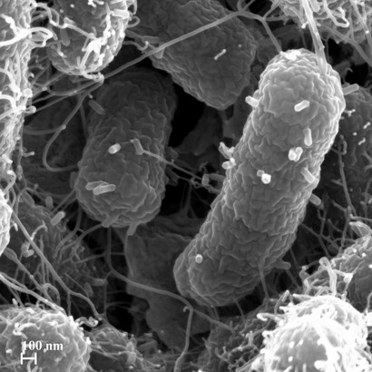 Immagine al microscopio elettronico a scansione del fago Escherichia vB_EcoP_SU10 (Kuravirus SU10) cinque minuti dopo la loro aggiunta alla coltura batterica. Si possono vedere particelle di fagi vuote adsorbite sulla superficie della cellula ospite. Di Mohammadali Khan Mirzaei, Harald Eriksson, Kie Kasuga, Elisabeth Haggård-Ljungquist, Anders S. Nilsson