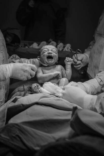 A cesarean section birth, emphasizing the need to listen to and respect women’s voices during labor