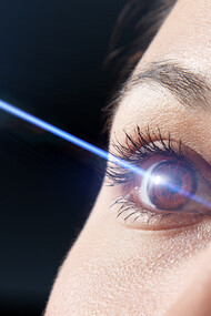 Lasik surgery