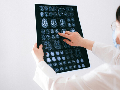 A physician analyzing and pointing at a brain MRI image