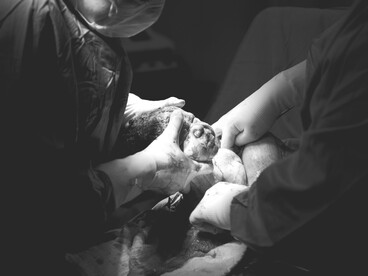 Grayscale photograph of a doctor carrying a newborn after a cesarean section in a hospital