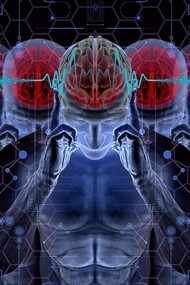 Chip nel cervello. Il primo uomo ha ricevuto un impianto da Neuralink e si sta riprendendo bene. I risultati iniziali mostrano un promettente rilevamento di picchi neuronali