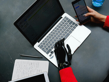 A woman with a prosthetic hand multitasks on her laptop and smartphone, showcasing modern accessibility and innovation
