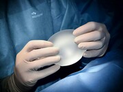 Cirurgião manipula prótese mamária. Em termos globais a cirurgia plástica mais realizada é o implante de silicone, seguida pela lipoaspiração. Sendo a segunda, líder no Brasil, representando um total de 15,5% das cirurgias realizadas em território nacional. De forma suscinta, um procedimento onde se realiza pequenas incisões no corpo afim de que cânulas (instrumento similar a agulhas) sejam inseridas para aspirar a gordura localizada