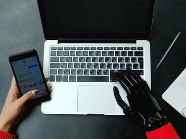 A woman with a prosthetic hand uses a laptop and smartphone, embracing technology in her daily life