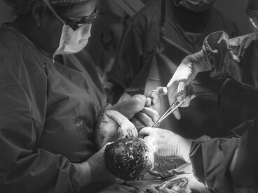Black-and-white photo of a doctor holding a baby during a C-section operation in a hospital