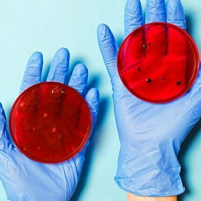 Certain mucins influence cell behavior, and changes in their levels or structure are linked to cancers and inflammatory diseases like asthma and bronchitis