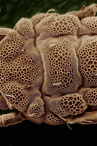 Ácaro del polvo ampliado bajo el microscopio