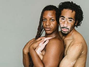 Multiethnic transgender men sharing an embrace