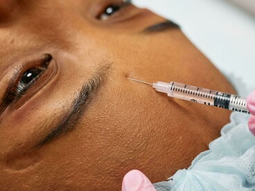 Botox is evolving beyond basic wrinkle treatment; the focus now is subtle, natural enhancement, not dramatic change