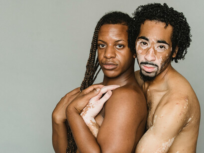 Multiethnic transgender men sharing an embrace