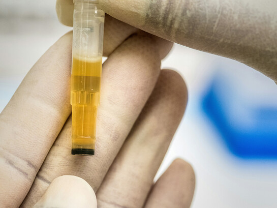 La recolección de orina en barrios del conurbano expone una trama poco visible donde lo cotidiano, lo legal y lo farmacéutico se cruzan en silencio