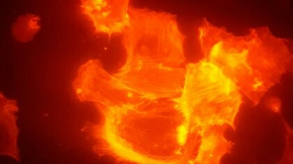 Células cancerosas cultivadas en un medio que contiene blebbistatina